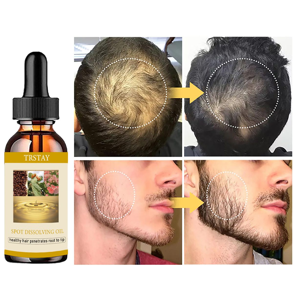 男性と女性のためのあごひげエッセンシャルオイル,ヘアケア製品 - Beard Oil のレビューと価格