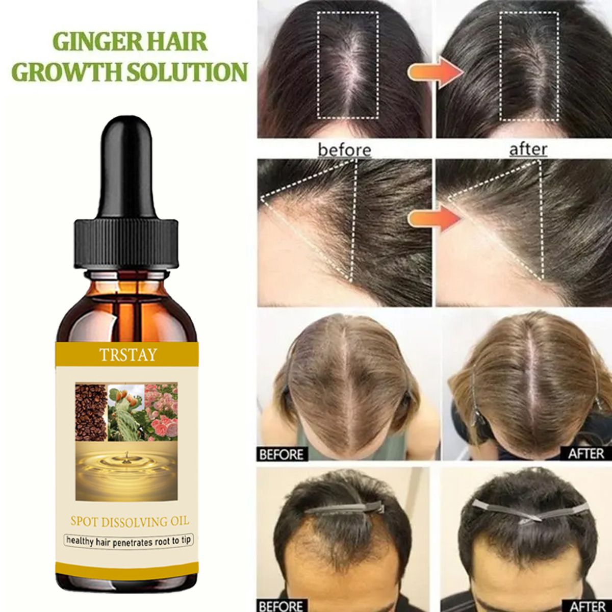 男性と女性のためのあごひげエッセンシャルオイル,ヘアケア製品 - Beard Oil のレビューと価格